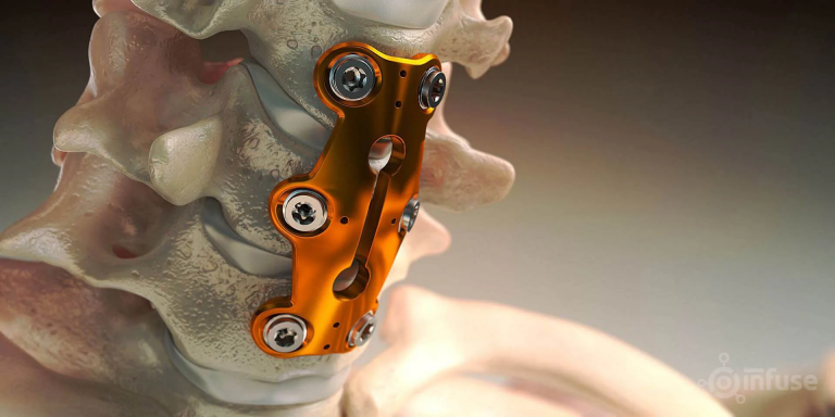 The Usefulness of 3D Medical Animation